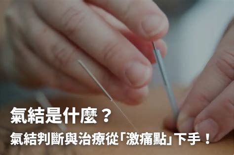 頭頂氣結|氣結是什麼？氣結判斷與治療從「激痛點」下手！